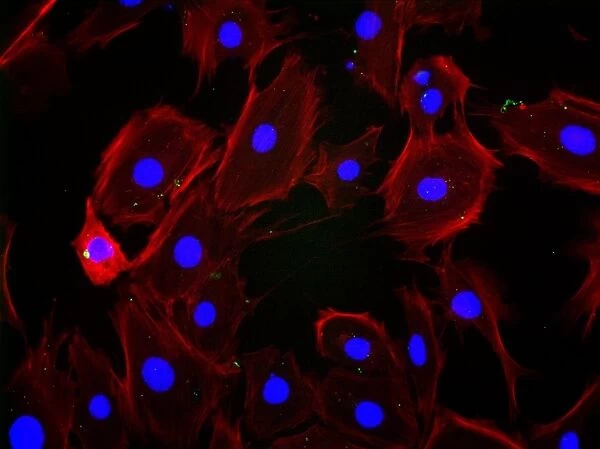 Fibroblast cells, fluorescent micrograph